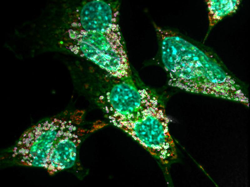 Gefährliches Fett: Deoxysphingolipide (grün) stören nicht nur die Arbeit der Mitochondrien (rot), sondern auch die Zellteilung. Manche von ihnen haben daher zwei Kerne (türkis). 