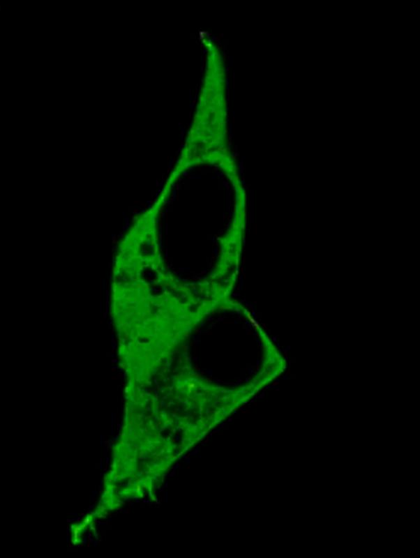 Dargestellt sind Zellen, die eines der Nanoruler exprimieren, mit denen Forscher*innen nanometergroße cAMP-Gradienten in intakten Zellen abbilden können.