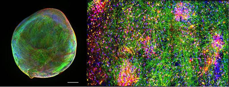 Left: A Bioengineered Neuronal Organoid (BENO); Right: High power magnification of a neuronal network in a BENO.