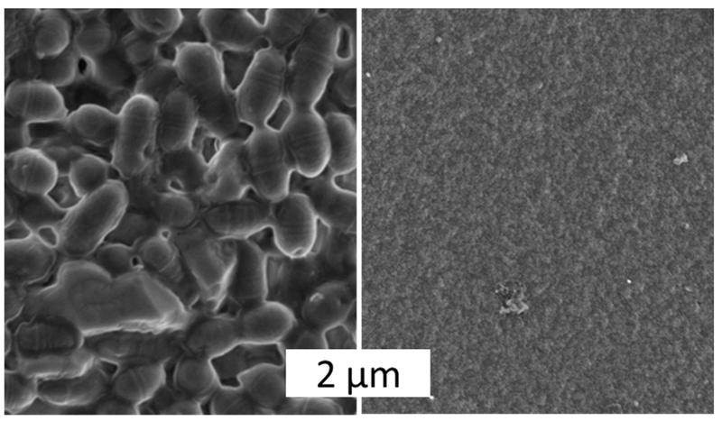 Scanning electron microscope images give overwhelming proof of the difference. Left: A biofilm forms on the surface of polycaprolactone, a biodegradable plastic frequently used in medicine. Right: Spider silk does not allow for biofilm formation. 