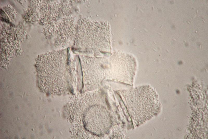 Mixed culture of the fungal pathogen Pseudomonas tolaasii and the helper bacterium Mycetocola tolaasinivorans.