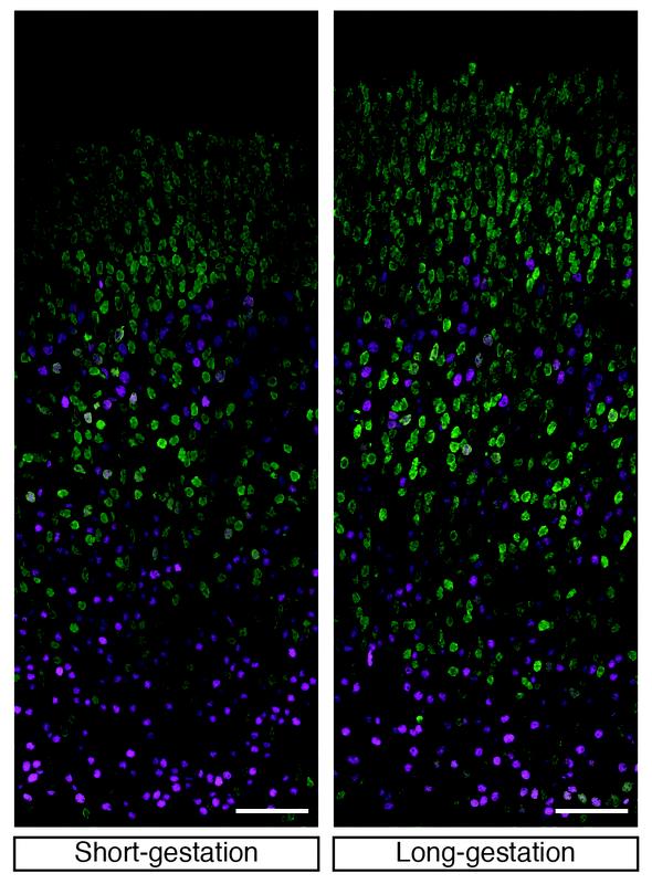 Deep-layer (magenta) and upper-layer (green) neocortical neurons in short- (left) vs long- (right) gestation mouse embryos. Note the increase specifically in the upper-layer neurons in the long-gestation mouse embryo. Scale bar, 50 µm. 