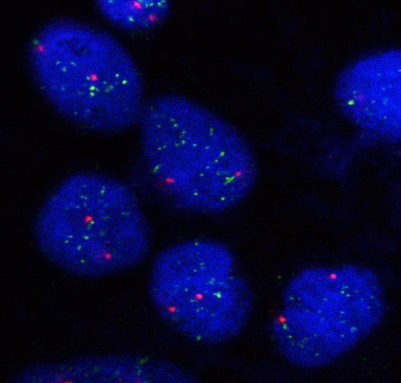 Fluoreszenz-markierte zirkuläre DNA (grün) in Zellkernen (blau) von Tumorzellen. 