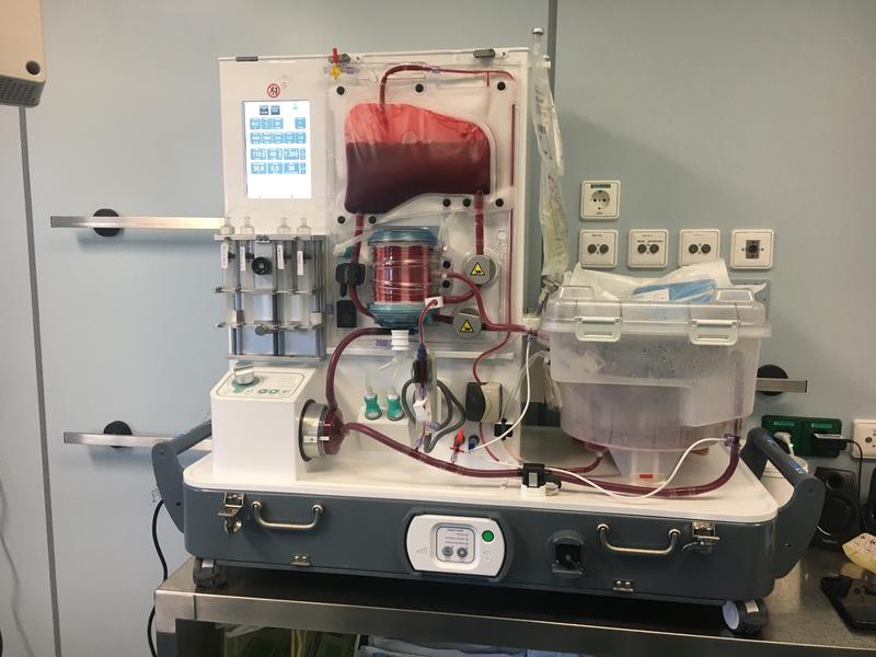 In diesem vollautomatisierten Organperfusionsgerät kann das Innere des menschlichen Körpers fast perfekt nachgebildet werden. Operateure haben mehr Zeit für eine Transplantation. Neben dem UKL besitzen derzeit nur zwei weitere Zentren eine solche Maschine.