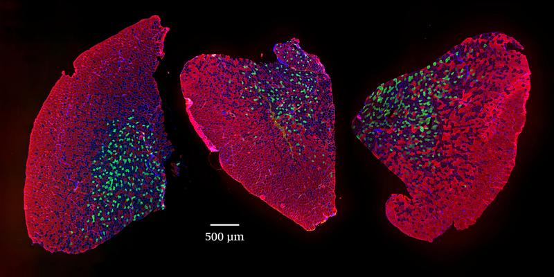 Muscle size decreases at high age and is preserved by rapamycin treatment (from left to right: mouse muscle cross sections from adult, old and rapamycin treated old mice).