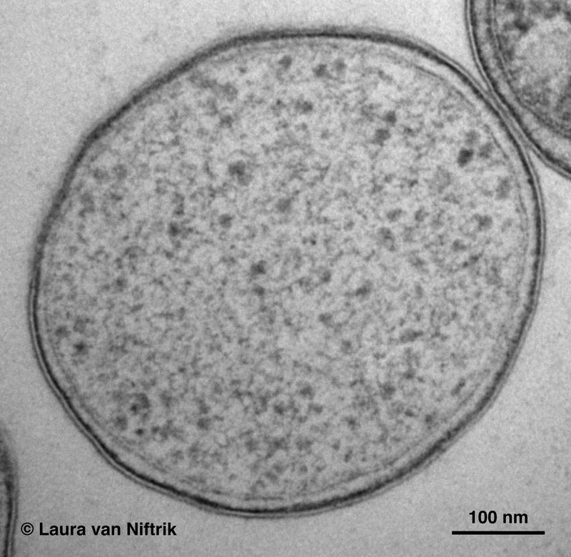 Unscheinbar, aber doch sehr bemerkenswert: Eine Zelle von Methylacidiphilum fumariolicum unter dem Elektronenmikroskop. 