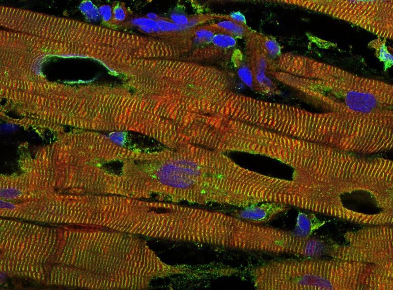 Immunfluoreszenzfärbung des Muskelgewebes eines chronisch erkrankten menschlichen Herzens im konfokalen Mikroskop.