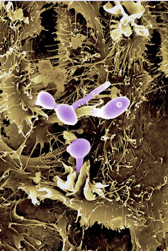 Der Hefepilz Candida albicans (violett eingefärbt) auf Epithelzellen.