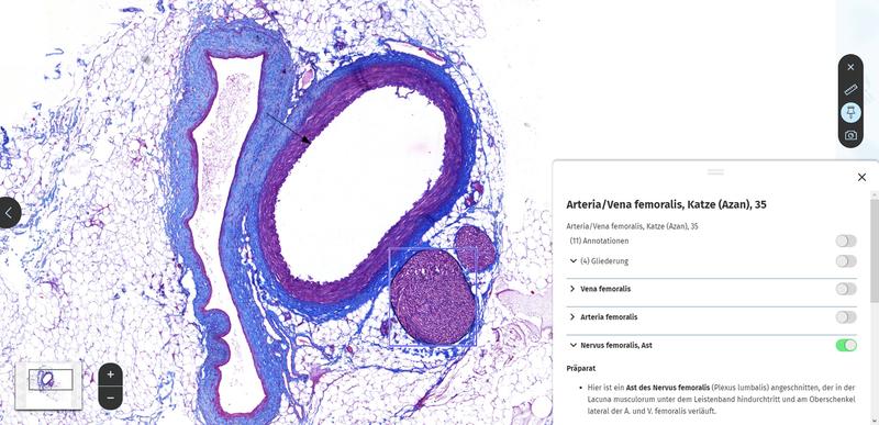 Screenshot aus der MyMi.mobile-App: Arteria/Vena femoralis (Azan-Färbung) 