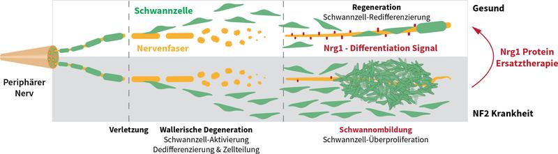Nach Nervenschädigungen teilen sich Schwannzellen und unterstützen die Regeneration. Neuregulin 1 (Nrg1) auf (regenerierten) Nerven beendet die Teilung. Fehlt Nrg1, teilen sich Zellen weiter und formen Tumore. Behandlung mit löslichem Nrg1 hemmt dies.