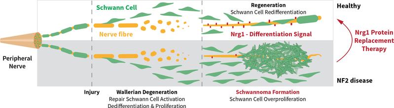 Upon nerve damage, Schwann cells divide to support nerve regeneration. Neuregulin 1 (Nrg1) on (regenerated) nerves stops this cell division. If Nrg1 is missing, cell division continues to form tumors. Treatment with soluble Nrg1 inhibits tumor formation.