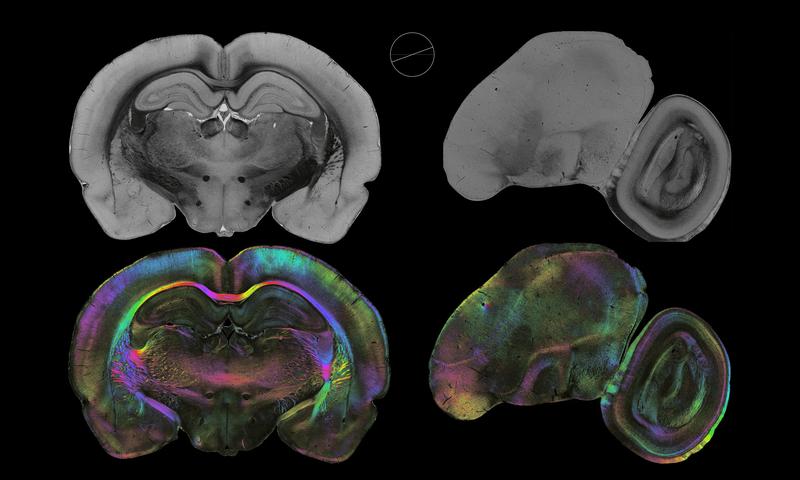 3D-PLI zeigt Ähnlichkeiten zwischen Ratte und Taube: Nervenfasern in den Gehirnen einer Ratte (links) und einer Taube (rechts), die mittels 3D Polarized Light Imaging (3D-PLI) sichtbar gemacht wurden.