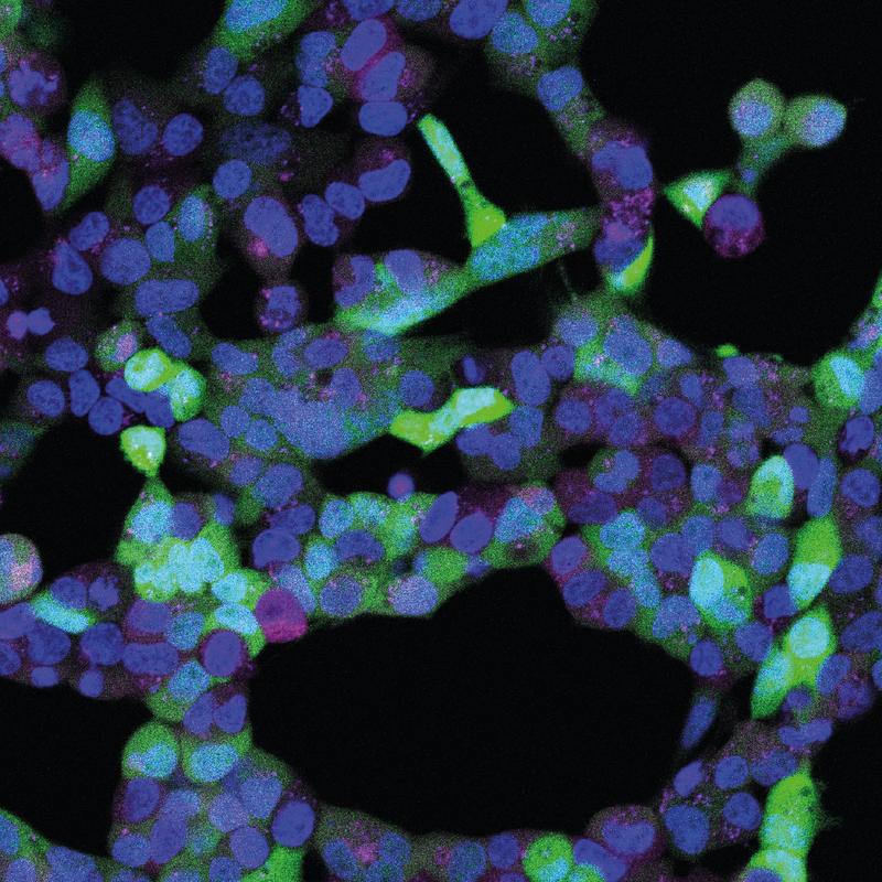 Das Bild zeigt Zellen, in die das Gen für einen grünen Farbstoff eingebracht wurde. Bei Beleuchtung wird die mRNA-Bauanleitung des Farbstoffs nicht abgebaut. Die Zellen leuchten daher grün. 