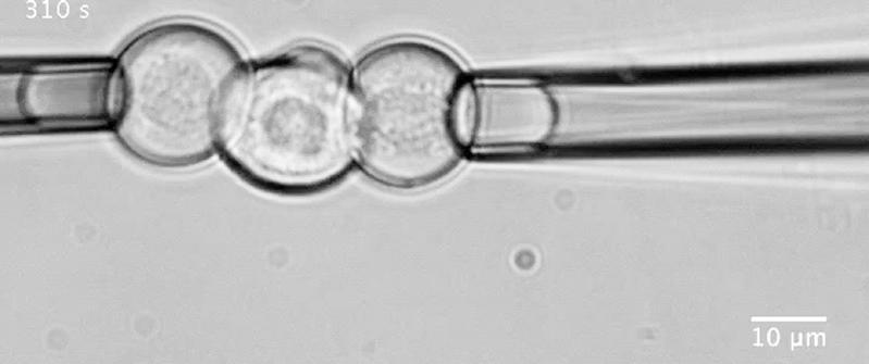 Mitttels Mikropipetten-Aspiration bestimmten die ForscherInnen die Deadhäsionskräfte zwischen neuronalen Vorläuferzellen. 