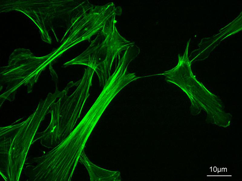 Proteinfasern geben Zellen eine Struktur. Wie sie sich im Getümmel des Zellinneren bewegen, haben Forscherinnen und Forscher anhand von Computersimulationen und einer analytischen Theorie untersucht.