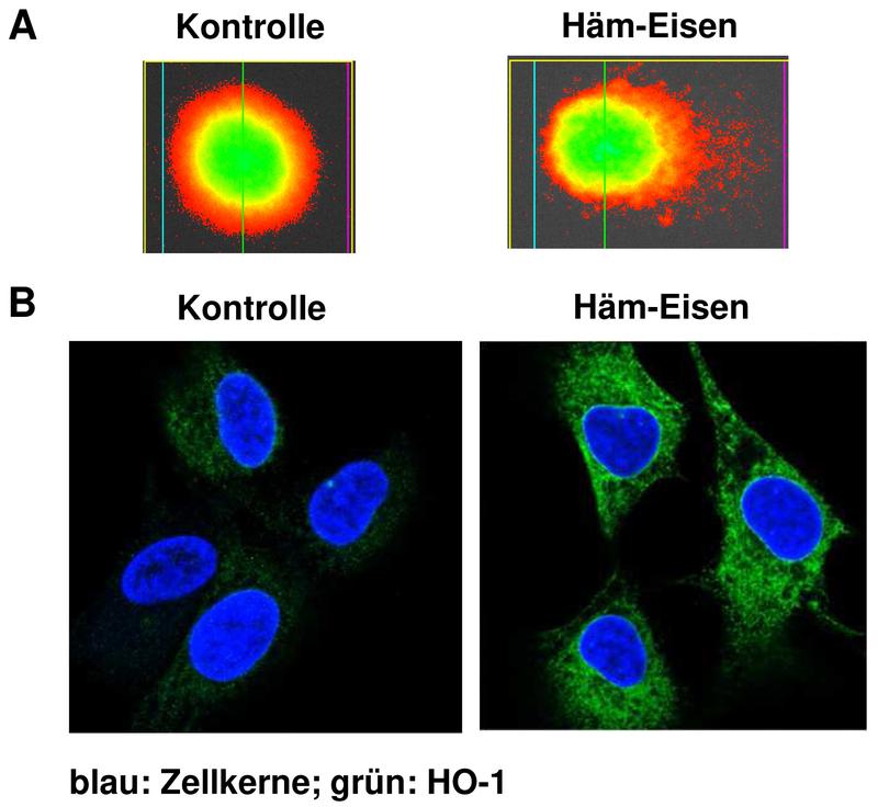 1A – Schädigung der DNA durch Häm-Eisen analysiert mit dem Comet-Assay. Der rechts zu sehende Schweif zeigt den DNA-Schaden. 1B – Expression von HO-1 als Schutzenzym visualisiert mittels konfokaler Immunfluoreszenzmikroskopie.