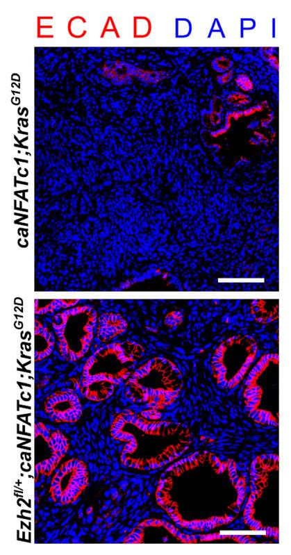 Tumoren der Bauchspeicheldrüse von Mäusen mit verschiedenen genetischen Merkmalen unterscheiden sich in der Struktur und ihren molekularen Charakteristika (rote Immunfluoreszenzfärbung).