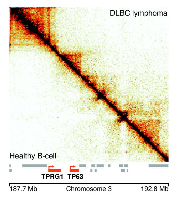 Darstellung der 3D Struktur des Genoms in Krebs- (über der Diagonale) und gesunden B-Zellen (unter der Diagonale). Bekannte Krebs-assoziierte Gene sind rot hervorgehoben.