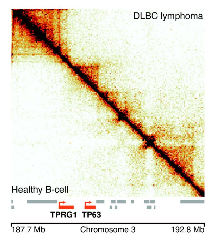 Representation of 3D genome structure for cancer (above the diagonal) and healthy B-cells (below the diagonal). Previously known cancer-related genes are highlighted in red.