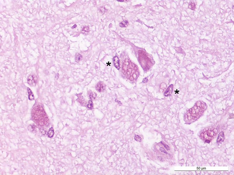 In der Färbung des etwa 245 Jahre alten Grönlandhai-Gehirns zeigen sich große Nervenzellen ohne Anzeichen pathologischer Veränderungen. Zudem fanden sich mutmaßliche Mikrogliazellen mit bohnenförmigem Zellkern und typischem Kernchromatin. Balken: 50 Mikro