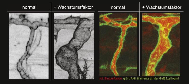 Darstellung natürlich wachsender lebender Arterien und fluoreszenzmikroskopische Darstellung des Blutflusses und des endothelialen Aktin Zytoskellets. Ausführliche Bildbeschreibung am Textende. (Abb.: ZOO, KIT)