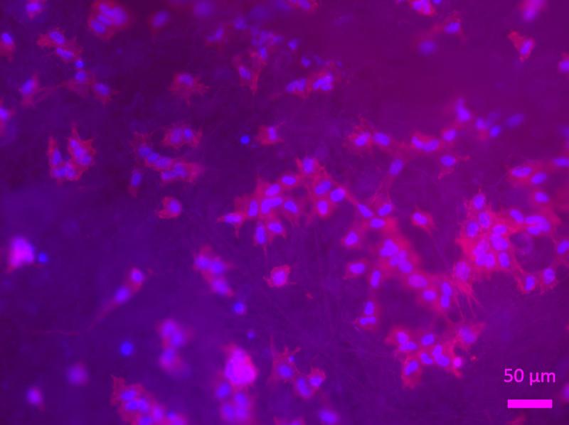 Das Forschungsteam am Lehrstuhl für Werkstoffwissenschaften (Biomaterialien) der FAU forscht am Elektrospinnen: der Herstellung von faserigen Biopolymerstrukturen, die die Morphologie von Sehnen nachahmen. 