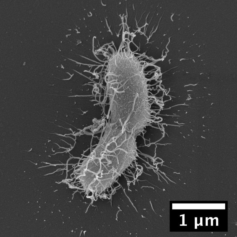 Scanning electron microscope image of the intestinal bacterium Prevotella rodentium. The species was isolated in the current study.