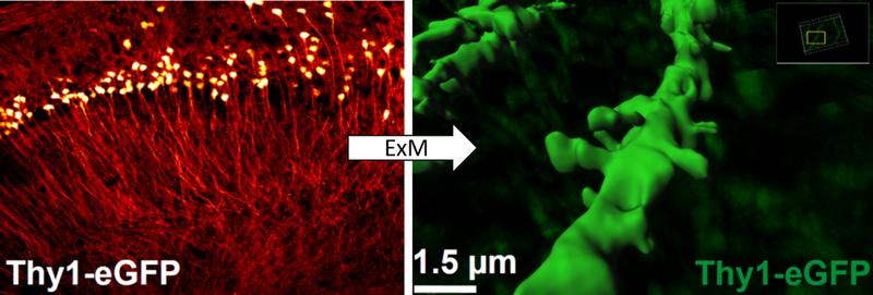 Superaufgelöste Bilder made in Würzburg: Mit der Expansionsmikroskopie lassen sich Feinstrukturen des Gehirns präzise darstellen, deren Gestalt sich bei Lern- und Gedächtnisprozessen verändert. Zu sehen sind Pyramidenzellen aus dem Hippokampus der Maus.
