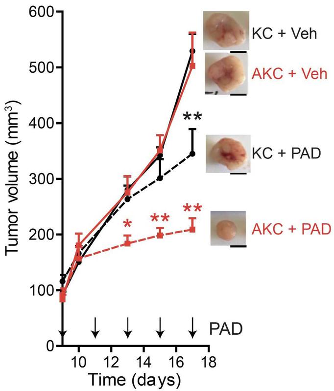 Im Mausmodell sprechen jene Tumoren mit zusätzlichem ATM Verlust (AKC) signifikant besser auf die Therapiekombination mit PARP, ATR und DNA-PK Inhibition (PAD) an, als die allgemein verwendeten Kontrollen mit einfacher KRAS Mutation (KC). 
