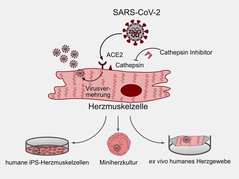 DZHK-Forscherinnen und Forscher konnten in Labormodellen zeigen, dass SARS-CoV-2 Herzmuskelzellen befallen kann. 