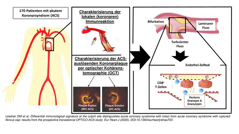 Ablauf der OPTICO-ACS-Studie