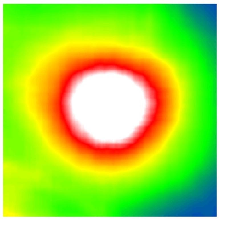 Vorhergesagte Netzhautdicke auf Basis von Fundus-Bildern.