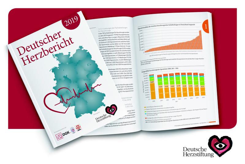 Der neue Deutsche Herzbericht 2019, Europas einzigartige herzmedizinische Versorgungsanalyse für Mediziner, Versorgungsforscher, Verantwortliche im Gesundheitswesen und Medienvertreter.
