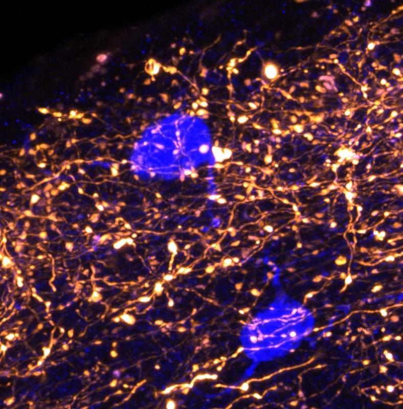 In der äußersten Schicht des Neokortex werden Informationen über das Gedächtnis durch Synapsen aus dem Thalamus (orange) empfangen, die wiederum von lokalen Neuronen (blau) reguliert werden.
