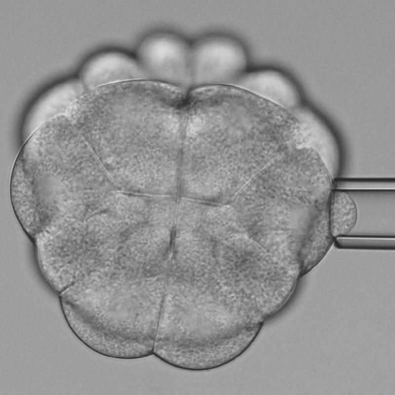 Measuring the stiffness of dividing cells