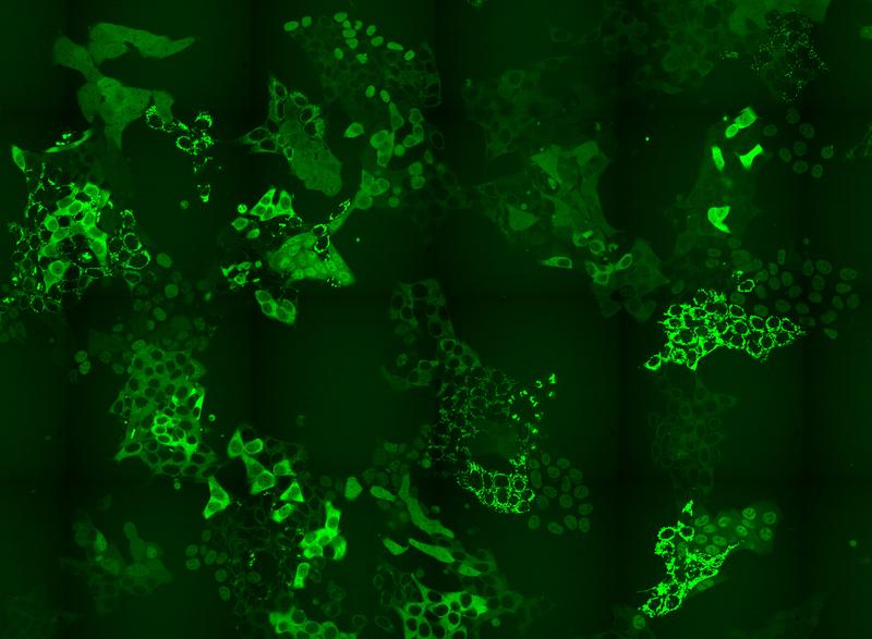 Illustration: Zellpool mit hunderten, GFP-markierten Proteinen