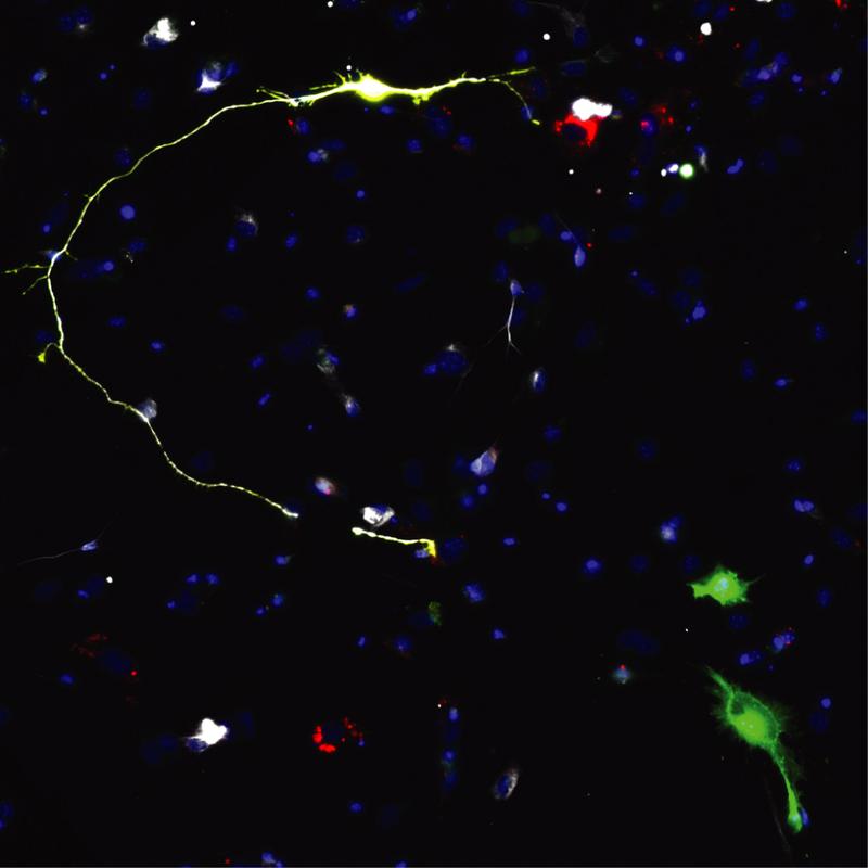 Reprogrammierte Neuronen bei Expression des proneuralen Faktors Ascl1