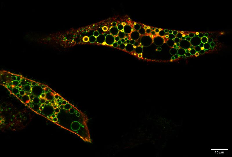 Mikroskopische Aufnahme zweier Zellen, die die krankheitserzeugende Mutante von ClC-6 (rot markiert) überproduzieren. Komplette BU unter dem Text 