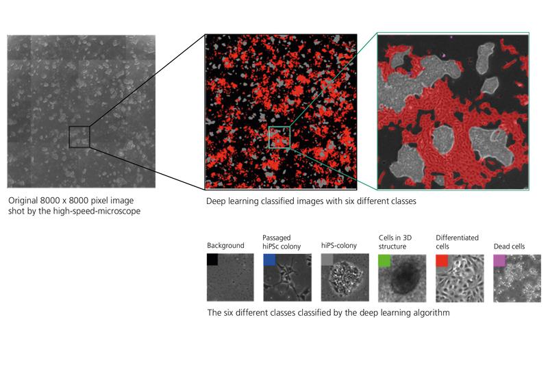 Die Zellen werden unter dem Mikroskop aufgenommen, das Softwaretool AIxCell klassifiziert die Zellen und sucht einen passendenden Deep Learning Algorithmus aus.