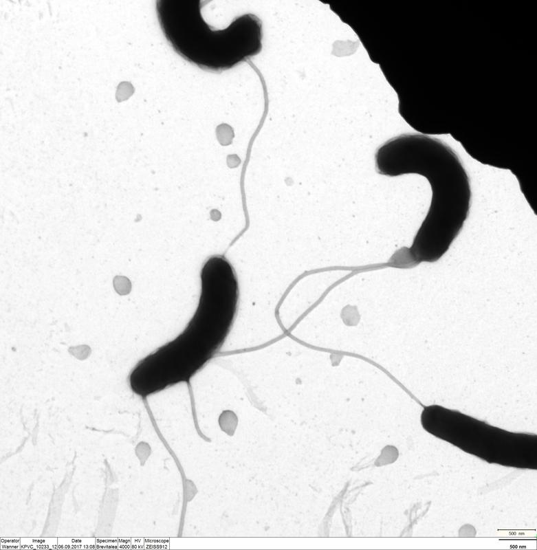 Cholera bacteria under the microscope. 