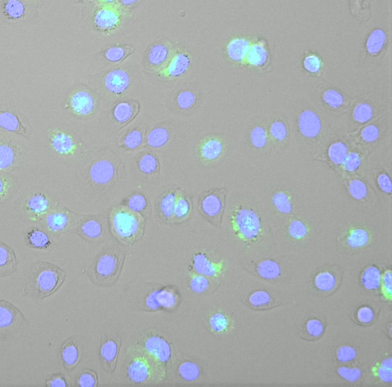 Keratinozyten-Zelllinie, die mit Semliki-Forest-Virus infiziert wurde (blau: Zellkerne; grün: doppelsträngige RNA). 