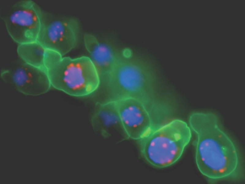 Group of primordial germ cells in a zebrafish embryo