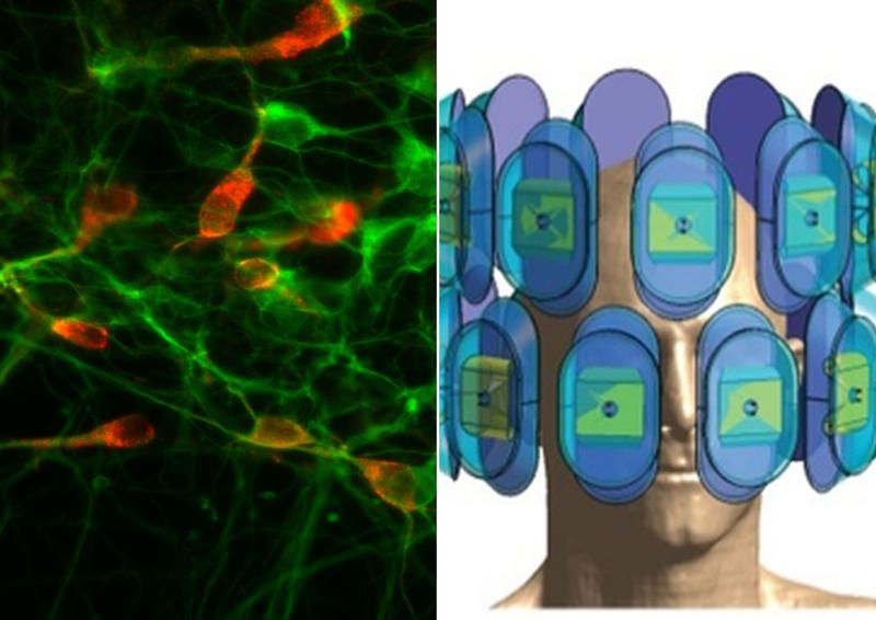 links: Auf Serotonin reagierende Neuronen (rot) im Gehirn der Maus. rechts: Computersimulation eines Hochfrequenzapplikators für MR-Tomographie gesteuerte Hyperthermie im Hirn. 
