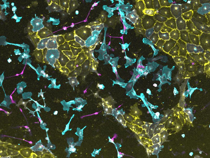 Three transgenic iPS lines, in each of which a different transcription factor can be activated, were mixed and induced to form a synthetic tissue within four days. Vascular cells are stained yellow, nerve cells magenta and connective tissue cells blue. 