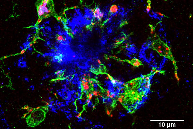 Blick ins Gehirn einer „Alzheimer-Maus“: Mikrogliazellen (grün) umranden einen Amyloid-β Plaque (blau), eine für die Alzheimer-Krankheit typische Eiweiß-Ablagerung. Die Lysosomen (rot) zeigen, dass die Mikrogliazellen in einem aktivierten Zustand sind.