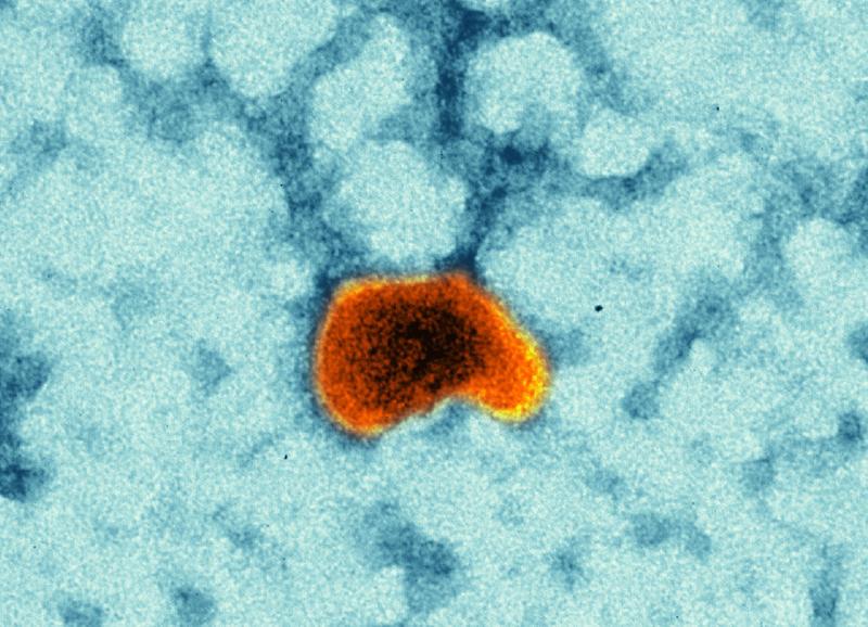 Impfvirus und Transportmittel in einem: Das Masernimpfvirus als Vektorimpfstoff.