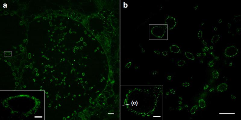 Sphingolipid-Expansionsmikroskopie (ExM) von zehnfach expandierten Zellen, die mit Chlamydien infiziert wurden.