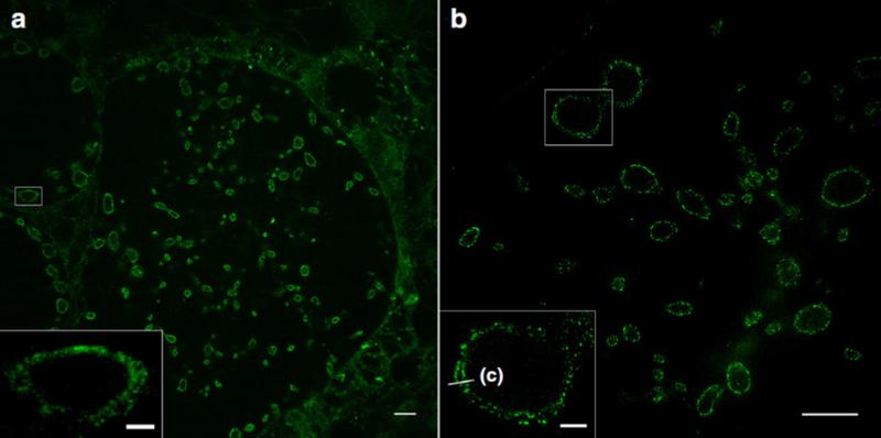 Sphingolipid expansion microscopy (ExM) of tenfold expanded cells infected with chlamydia.