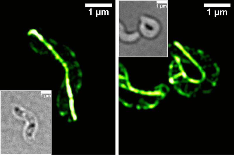 Hochauflösende Fluoreszenzmikroskopie (3D-SIM) und Durchlichtaufnahmen der Zellform (weiß umrandet): In der Bakterienzelle besitzt CcfM eine filamentöse Struktur (li). Eine Überproduktion von CcfM bewirkt eine starke Zunahme der Zellkrümmung (re.). 