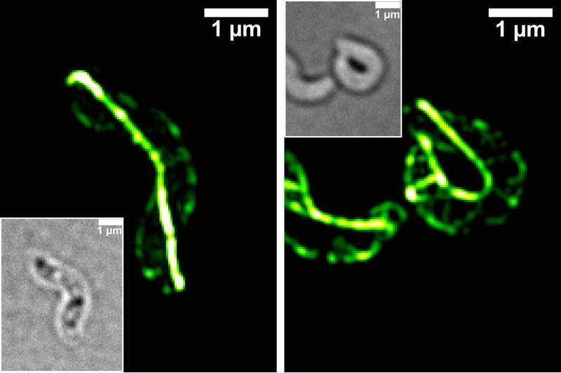 Super-resolution fluorescence microscopy (3D-SIM) and brightfield images of cell shapes (white bordered micrograph): In the cell, CcfM forms a filamentous structure (left). Overproduction of CcfM causes a strong increase in cell curvature (right).